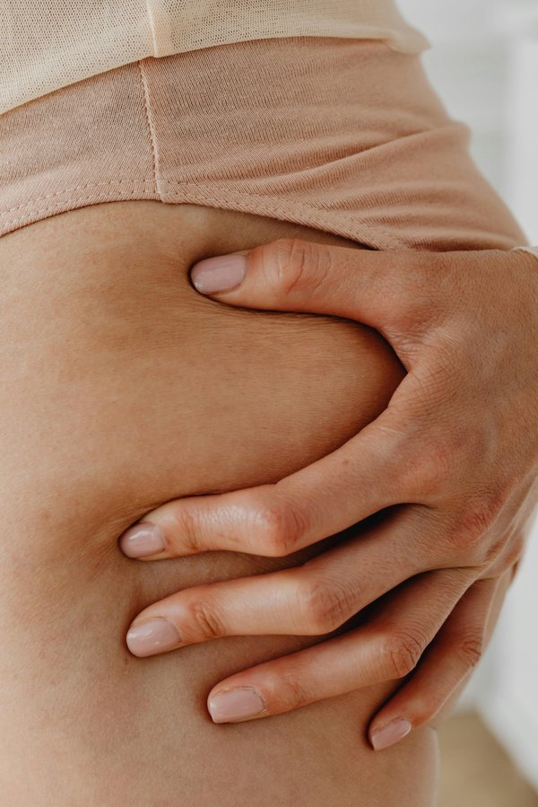 Les démangeaisons anales : symptômes, remèdes et prévention